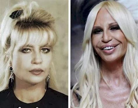 caratteristiche stile donatella versace|donatella versace face what happened.